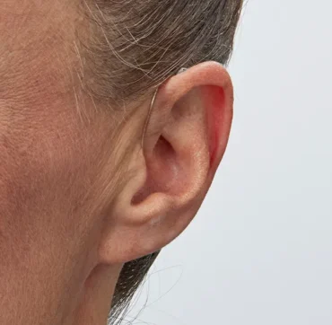 Oticon_Intent_miniRITE_H1-2024_C090ChromaBeige_AngleF45_Close-up_In-On-Ear_MS-6170_Woman_1200x800px_Original file